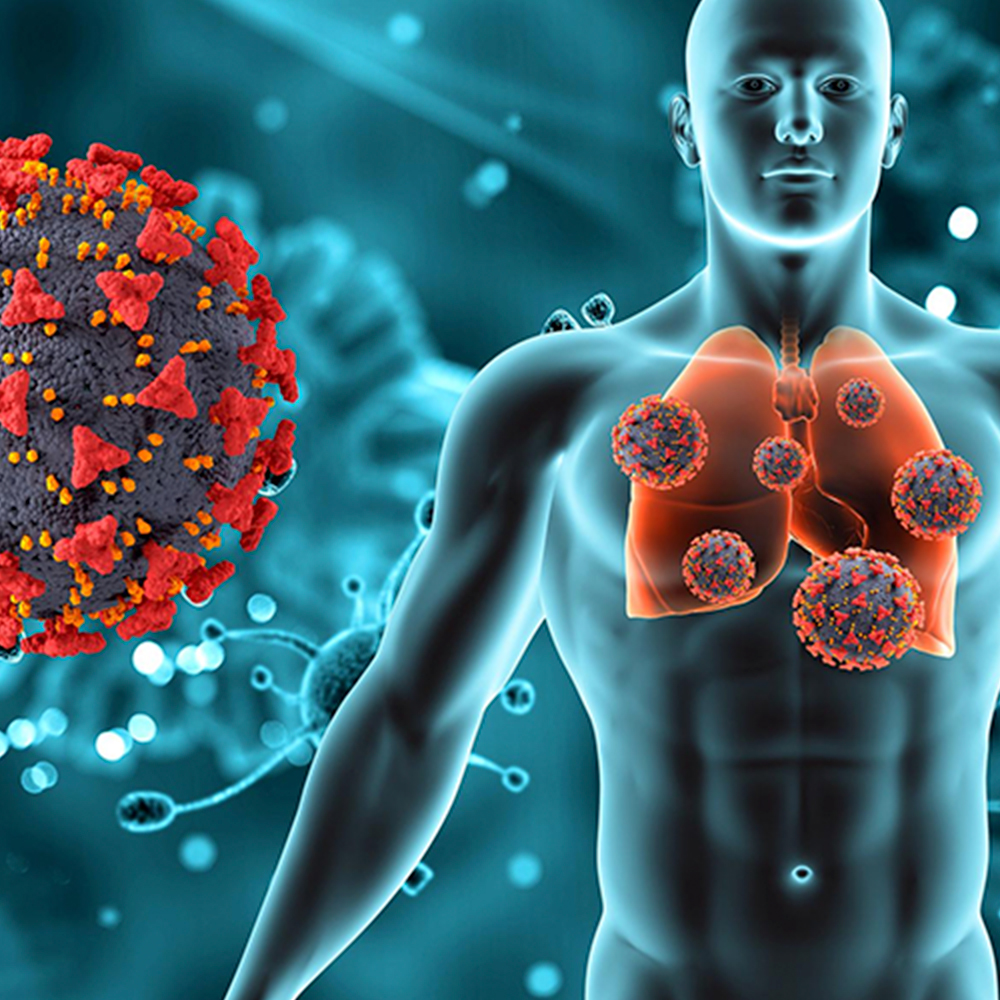 Terapia Celular de Fibrosis Pilmonar Post COVID